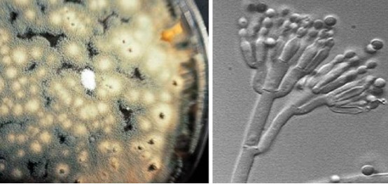 UV Light vs. Fungi: Can Ultraviolet Disinfection Stop Mold Growth?
